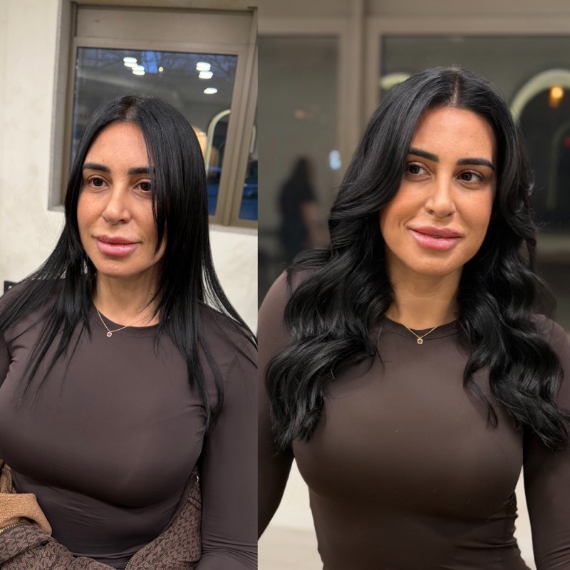 Antes e depois de balayage HER, resultado 12